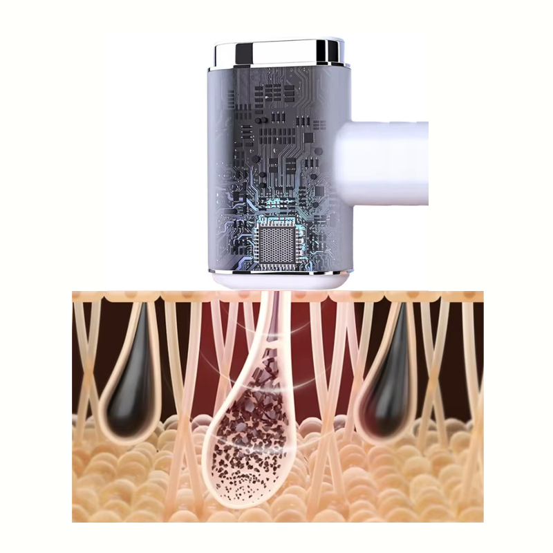 SmileSkin IPL- Haarentferner
